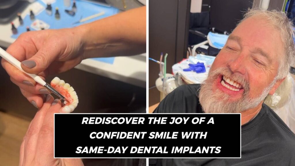 Custom Dentures - Real patient smiling with implant dentures from Brentwood Dentist Dr. Ashish Patel