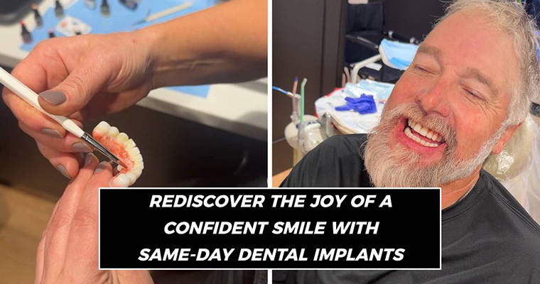 Implant Retained Dentures Brentwood TN